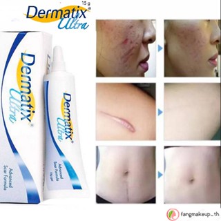 Dermatix ultra acne scar เจลลดรอยแผลเป็นจากสิว สูตรขั้นสูง 15 กรัม