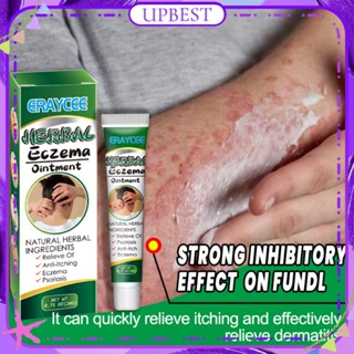 ♕ Eraycee Herbal Eczema Ointment Inhibit Bacteria Relief Skin Dry Itching Peeling Swelling Psoriasis Natural Ingredient Treatment Body Care 20g UPBEST