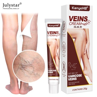 JULYSTAR เส้นเลือดขอดบรรเทาครีมขา Vasculitis Phlebitis Spider Shape Vein Pain Ointment สมุนไพรจีนปูนปลาสเตอร์ทางการแพทย์ Care