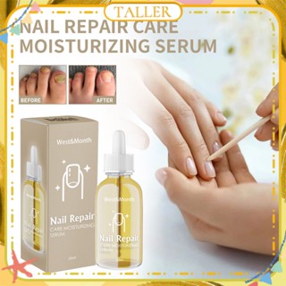 พร้อมส่ง Stcok West&amp;month Nail Repair Care Moisturizing Serum Anti Itching Burning Scaling Cracking Nursing Solution Natural Herbal Treatment Body Care 20ml TALLER