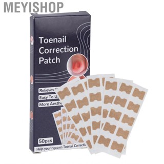 Meyishop 50Pcs Ingrown Toenail  Strong Adhesion Safe Breathable Easy To Use Toena