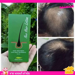 Neo Hair Lotion นีโอ แฮร์ โลชั่น สเปรย์ เซรั่ม น้ำยาปลูกผม เร่งผมยาว สมุนไพร green wealth