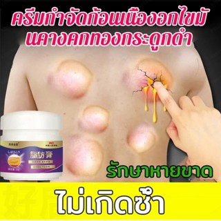 【ซื้อ 1 ฟรี 2】ครีมกำจัดก้อนเนื้องอกไขมันคางคกทองกระดูกดำ