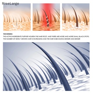 [RiseLarge] ใหม่ สบู่ข้าวปั้น แชมพู ส่วนผสมจากธรรมชาติ 1 ชิ้น