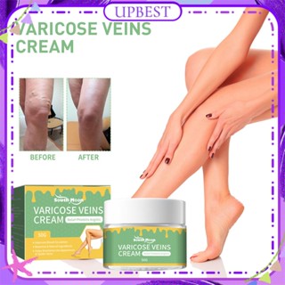 ♕ South Moon Vein Repair Cream Leg Massage Relief Pain Discomfort Repair Earthworm Leg Vein Care Cream Natural Herbal Treatment Body Care 50g UPBEST