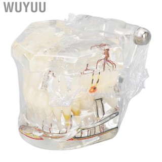 Wuyuu Disease Implant  Model Dental