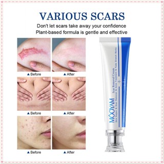 Mooyam Scar Removal Cream Repair Surgical Scar Stretch Marks Acne Pox Print Inhibit Scar Deterioration Moisturizing Skin Ointment Body Care Product 1pc JOYFEEL