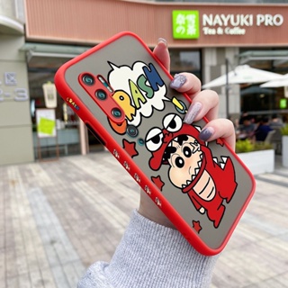 เคสซิลิโคนใส ขอบสี่เหลี่ยม กันกระแทก ลายการ์ตูนชินจัง สําหรับ Xiaomi Note 10 Note 10 Lite