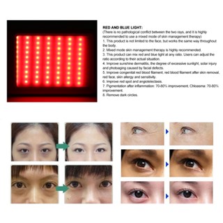 Mother &amp; Baby Red Blue Light Therapy การกำจัดสิวเครื่องมือเสริมความงาม Photon Skin Rejuvenation Machine