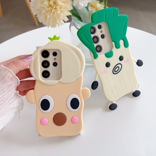 เคสซิลิโคนนิ่ม ลายหัวหอม สําหรับ Xiaomi POCO X3 F2 F3 C40 M2 M3 M4 M5 F4 F5 X5 X4 PRO X3GT F4GT C50 C55