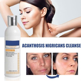 Cleansing Lotion for Acne Spots Acanthosis Nigricans Therapy Dark Spot Corrector