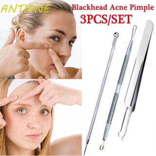 Antione ชุดเครื่องมือแหนบ สําหรับปัตตาเลี่ยน กําจัดสิวเสี้ยน สิวเสี้ยน สิวหัวดํา