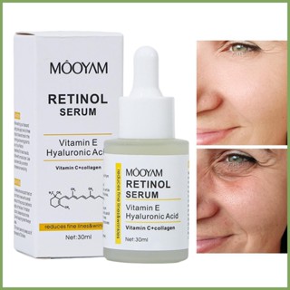 Retinol Essence, ต่อต้านริ้วรอย, เจือจางริ้วรอย, ประกอบด้วยวิตามินเอแอลกอฮอล์, วิตามินอีกรดไฮยาลูโรนิก