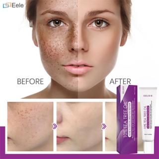 EELHOE Whitening Freckle Cream ครีมทาฝ้า Pekas Remover Dark Spots Remover Brighten Skin Anti-Aging ↑Eele