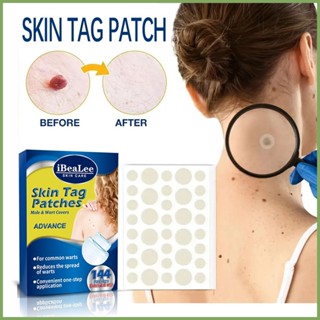 Skin Tag Remover Patch แพทช์สิวสำหรับใบหน้าผู้หญิงผู้ชาย Skin Care สติกเกอร์แพทช์สำหรับถอด Skin Tags หูดสิว