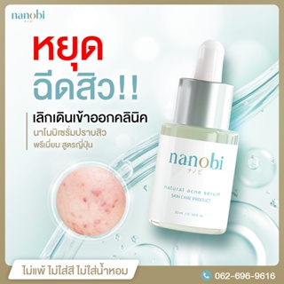 💚นาโนบิ💚 nanobi เซรั่ม รักษาสิว จากญี่ปุ่น สารสกัดวาซาบิ ธรรมชาติ ผิวหน้า ไม่แพ้ สิวหาย ไม่เกิดซ้ำ