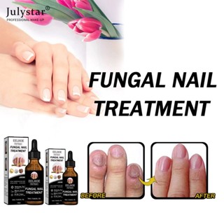 JULYSTAR Eelhoe Nail Fungus Treatment Ingrown Toe Nail Drops Original หยุดการเจริญเติบโตของเชื้อรา Essential Oil Grey Nail Care