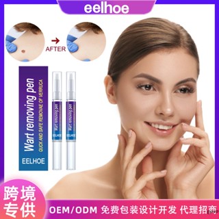 ปากกากําจัดหูดบนใบหน้า อย่างรวดเร็ว
