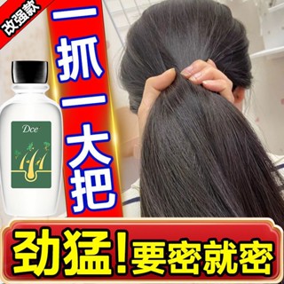 Hot Sale# Long hair anti-detachment long hair anti-baldness artifact hair growth and hair care liquid tight hair Baldness hairline fast hair growth agent 8.26Li