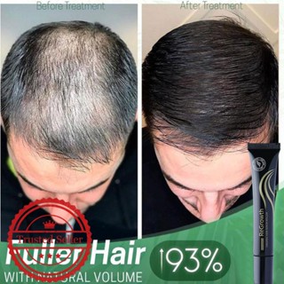 Regrowth เซตลูกกลิ้งเซรั่มบํารุงเส้นผม ออร์แกนิก ป้องกันผมร่วง 20 มล. F7V7