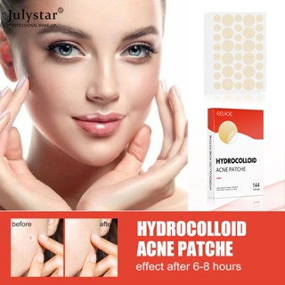 JULYSTAR กันน้ำ Acne Pimple Patch สติกเกอร์รักษาสิว Pimple Remover เครื่องมือที่มองไม่เห็น Ibreathable Acne Patch Skin Care 144 patches