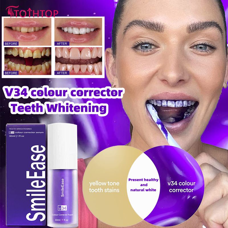hismile v34 ยาสีฟัน ยาสีฟันสีม่วง มายสมายล์ ยาสีฟัน ฟอกฟันขาว ต่อต้านอาการเสียวฟันและซ่อมแซมเหงือก [TOP]