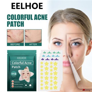 Eelhoe 112patches Star Acne Paste Diluted Spots To Repair Acne Acne Acne Marks Covering Acne and อะไหล่สติ๊กเกอร์ซ่อมสิว (monkingstore_th)