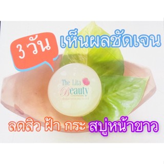 สบู่3วันหน้าขาว|ลดสิว|ฝ้าจางหาย|ลดกระ|จุดด่างดำ| สบู่สำหรับทำความสะอาดผิวหน้าผสมน้ำคั้นหัวไชเท้าสกัดสด