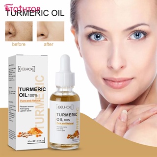 Eelhoe Turmeric Dark Spot Correction Serum Repair Facial Skin Care Moisturizing Whitening Clean Fight Acne Even Tone Dull Dry 30ml [TOP]