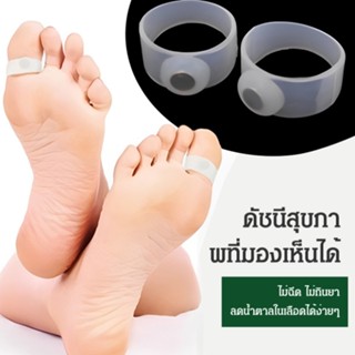 【ซื้อ 1 แถม 1】แหวนซิลิโคนแม่เหล็ก/แหวนซิลิโคน