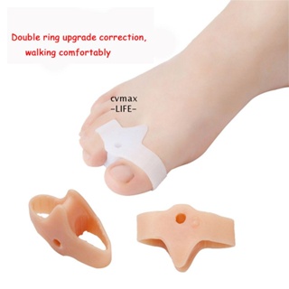 CYMX Hallux Valgus Corrector ซิลิโคนนิ้วหัวแม่มือ แก้ไขนิ้วเท้า เครื่องใช้ภายนอก กระดูกตาปลา