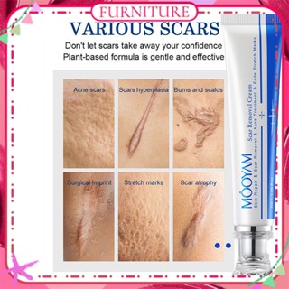 ♕ Mooyam Scar Removal Cream Repair Surgical Scar Stretch Marks Acne Pox Print Inhibit Scar Deterioration Moisturizing Skin Ointment Body Care Product FURNITURE มูยัม ครีมลบรอยแผลเป็น