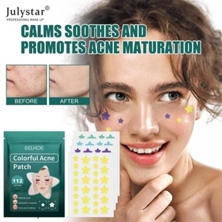 JULYSTAR สิวที่มองไม่เห็นแพทช์สิวดาวเครื่องมือสิวสิวคอนซีลเลอร์สิว Face Spot Scars Care สติกเกอร์