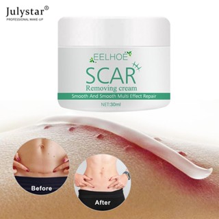 JULYSTAR Eelhoe Scar Removal Cream For Old Scars Stretch Mark Spots Gel. ครีมกำจัดรอยแผลเป็นปลาไหลสำหรับรอยแผลเป็นเก่า