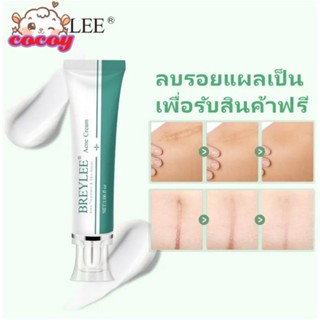 cocoy 【fast Delievery】 Scar Cream Fades Repair Scars Acne Scar Cream 30g