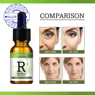 Retinol เอสเซ้นบํารุงผิวหน้า ให้ความชุ่มชื้น B9S1