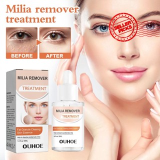 Milia Remover Essence เอสเซ้นส์เม็ดไขมัน เซรั่มล้างผิว ซ่อมแซม Milia ต่อต้านสิวใต้ผิว T0I8 30 มล.