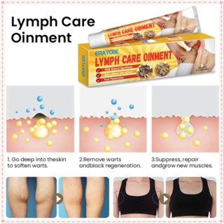 Eraycee Lymph Node Elimination Ointment ใต้วงแขน คอ ต่อมน้ำเหลืองกระจายตัว ลดการบวม ความเมื่อยล้า ส่วนผสมจากธรรมชาติ ทรีทเมนท์ดูแลผิวกาย 1 ชิ้น JOYFEEL