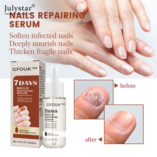 JULYSTAR 7 วันเล็บซ่อม Essence มือเท้า Onychomycosis เล็บเท้าเน่านุ่มเล็บหนาการรักษามอยซ์เจอไรเซอร์ดูแล Essence Body Care 20ml