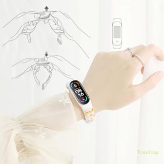 Treeling สายนาฬิกาข้อมือ กันน้ํา สําหรับ Mi Smart Watch 5 4 6