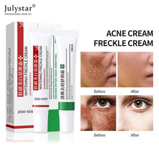 JULYSTAR Skin Research Whitening Anti-freckle Cream Moisturizing Color-lifting Cream Refreshing Not Irritating Oil Control Anti-acne Skin Care Produit ผลิตภัณฑ์ดูแลผิว