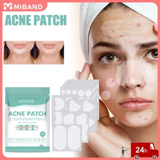 คลังสินค้าพร้อม Eelhoe 2023 Ins Hot Acne Patch 132 ชิ้น Hydrocolloid 100%, Daily Acne Spot Treatment, Quick Recovery Women Femle Students Face Care