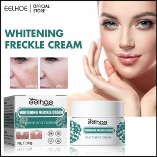 EELHOE ไวท์เทนนิ่งและครีมกระเพื่อขจัดเกลื้อน Acne Spot Pigment Face Cream -eelhoe