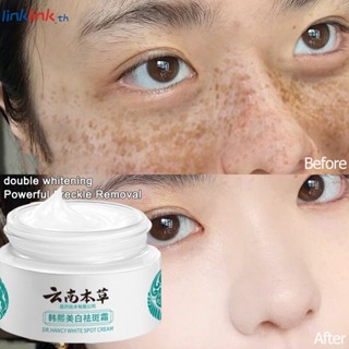 Han Xi Freckle Remover Cream ลบเม็ดสีฝ้า จุดเมลานิน Anti Freckle Face Whitening Cream Dark Face Care Cream Brightening Skin Color Moisturizing and Spot Removing Cream Linklink