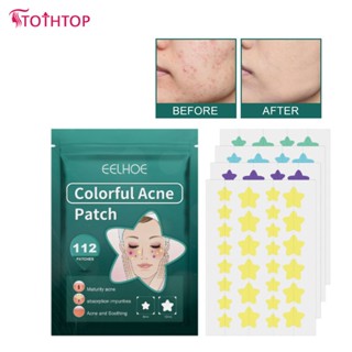 Eelhoe 112pcs Waterproof Acne Patch Blemish Treatment Skin Care Acne Repair Oxidation Acne Star Pimple [TOP]