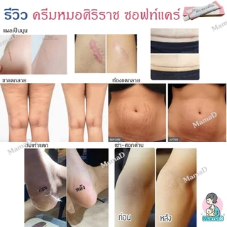 (แพคเกจใหม่)ซอฟท์แคร์ ศิริราช ลดรอยแผลเป็น ลดผิวแตกลาย ท้องลาย แผลนูน Siriraj Softcare