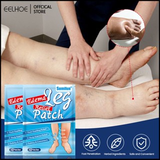 Sumifun Edema Paste Leg Edema Foot Care Sub-health ฟิล์มเท้า หน้ากากเท้า -eelhoe