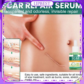 ♕ Eelhoe Scar Repair Serum Dilutes Bump Surgical Scar Repair Acne Pit Print Moisturizing Brightening Skin Tender Essence Body Care 30ml UPBEST