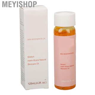 Meyishop Scars   Smoothing Stretch Marks Care Oil Nourishing Deep Hydration Vitamin E Moisturizing for Buttocks Women