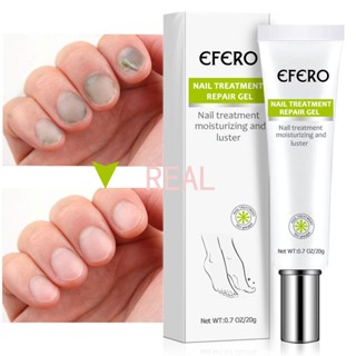 CYREAL Efero Fungal Nail Treatment Repair Essence Foot Nail Fungus Removal Gel Anti Infection Paronychia Onychomycosis Nail Treatment Feet Care Mild ไม่ระคายเคือง